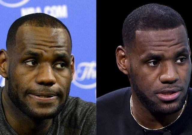 LeBron James hairline