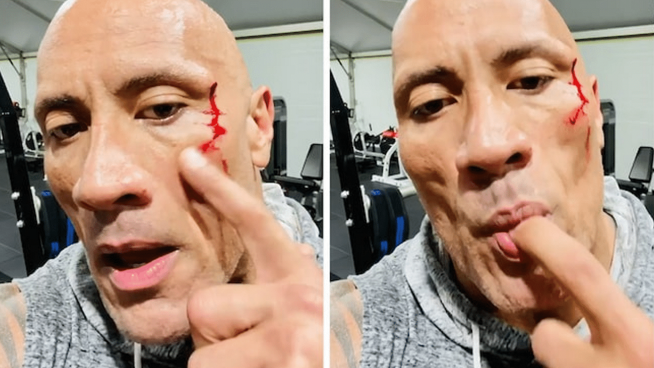 The Rock bleeds after suffering face injury
