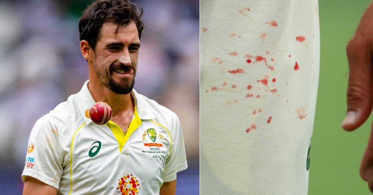 Mitchell Starc finger injury: Mitch Starc finger blood photos from Boxing Day Test