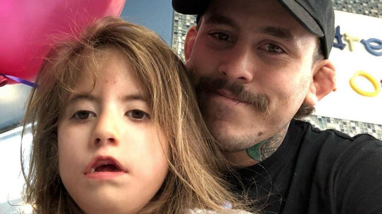 Marlon Vera Daughter: Ana Paula’s Tragic Medical Condition Moebius Syndrome Explained